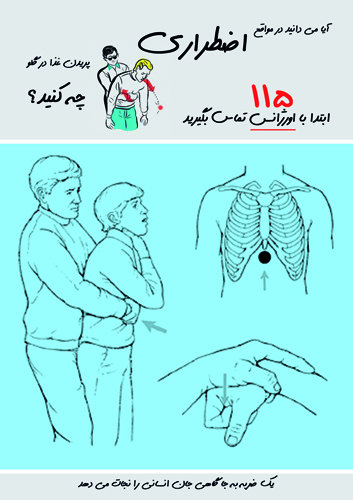 پیشگیری از خفگی ناگهانی با مانور هايمليخ *